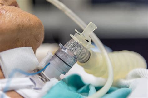 breathing tube mismanagement  lead  death   injury schwaner injury law