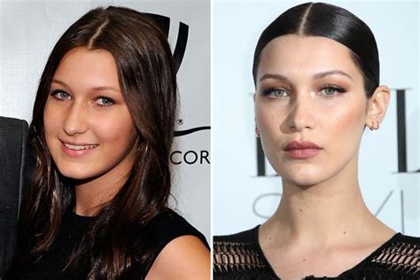 bella hadid insists she s never had surgery or fillers because she s