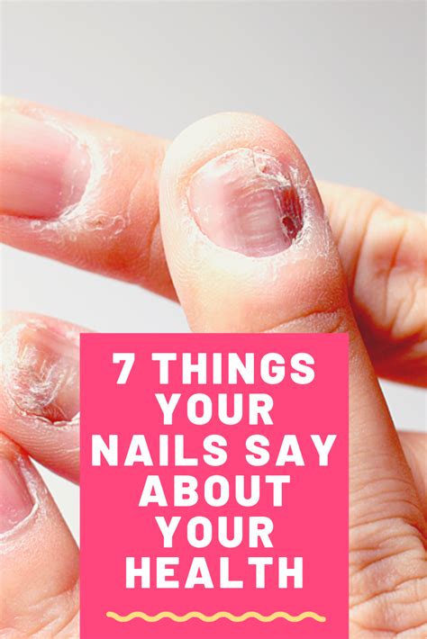 7 Things Your Nails Say About Your Health You Should Know What Causes