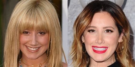 ashley tisdale s nose job face before and after surgery