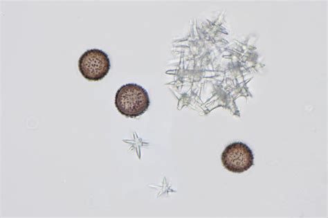 mucilago crustacea spores micropix flickr