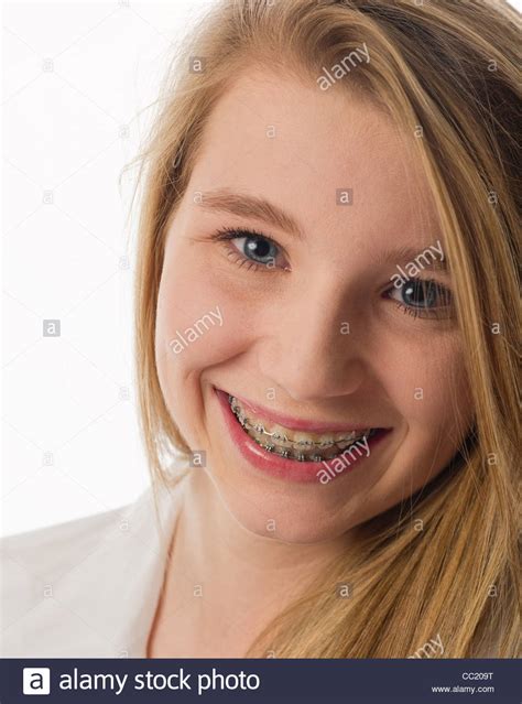Close Up Of A Teen Girl With Braces Smiling At The Camera