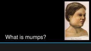 mumps symptoms methods  prevention  treatment january