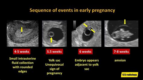week pregnancy ultrasound