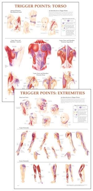 trigger point chart set australian physiotherapy equipment
