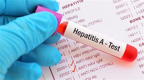 hepatitis   explainer   disease