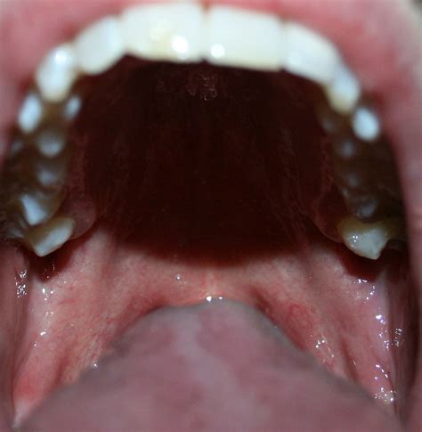 saliva girl tongues