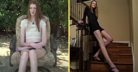 texas teen wins guinness world record for the longest legs
