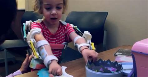 3d Printer Helps 4 Year Old Girl Who Can T Use Her Arms Play With Toys