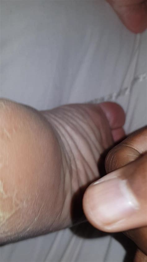 mature bbw granny with rough dry wrinkled soles back