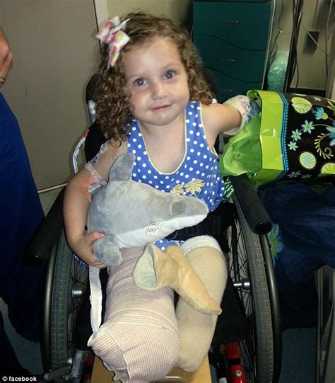 amputee ireland nugent mother says we tell her she s like mr potato head popping her feet on