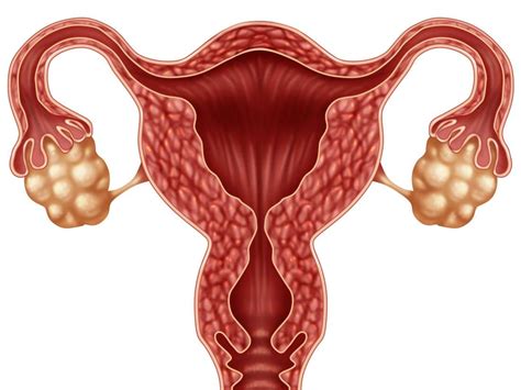 sex after a hysterectomy what you need to know