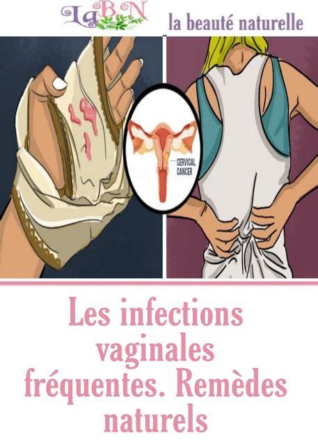 Les Infections Vaginales Fréquentes Remèdes Naturels Beauty Hacks