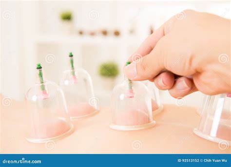 cupping therapy spa woman removes stock photo image  heal care