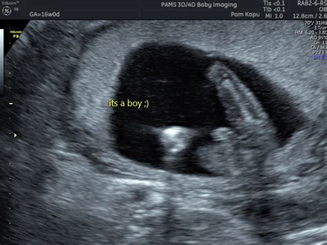 gender reveal scan private one on one pregnancy and fertility