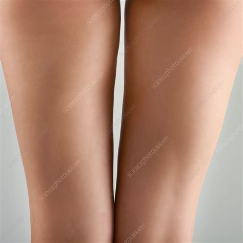 womans thighs stock image  science photo library