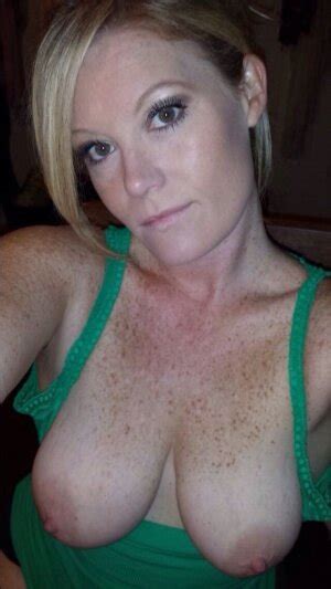 Freckles Pics Sex