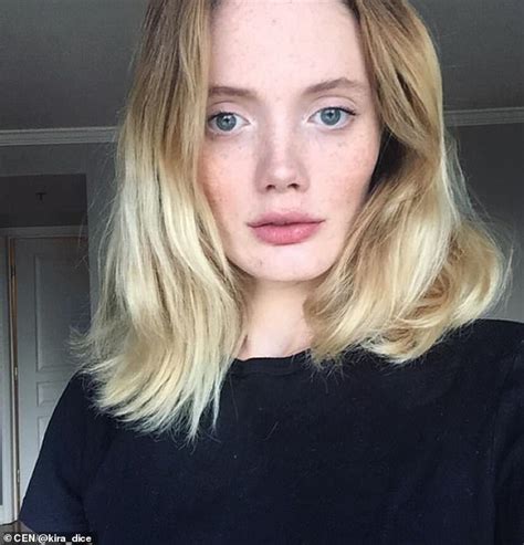 Russian Vogue Model Shares Her Horrific Domestic Abuse Story Daily