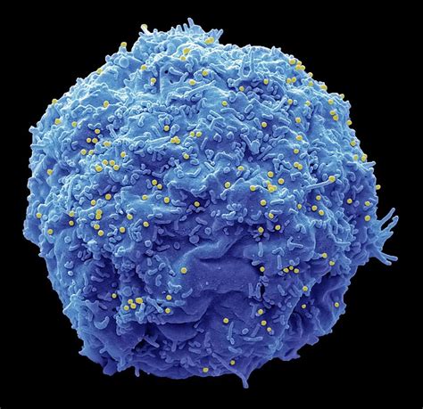 Hiv Infected Cell Photograph By Steve Gschmeissner Science Photo