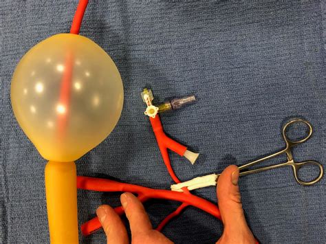 air care series balloon tamponade  variceal hemorrhage taming  sru