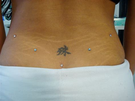 dermals dermal anchor    roger
