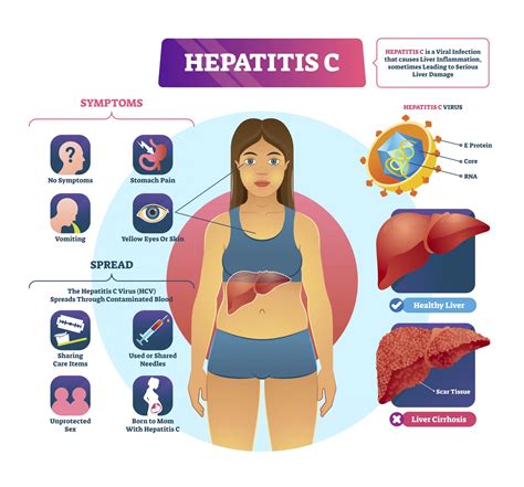 hepatitis  gutcare