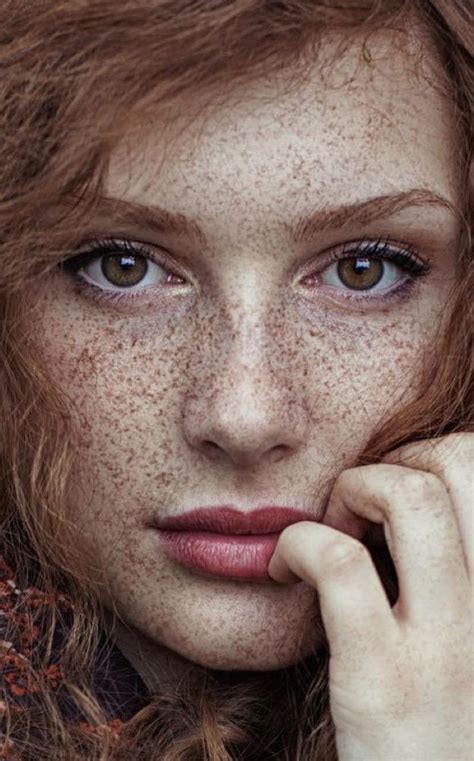 Pin On Freckled