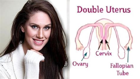 Woman Born With Two Vaginas Reveals What It’s Really All About… Daily