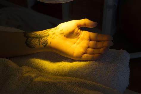 bioptron lichttherapie licht ist leben praxis sibylle buehlmann