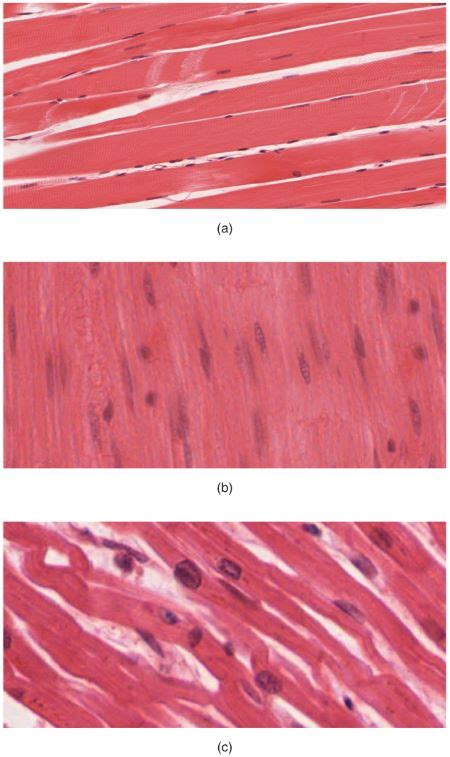 the photo below shows three types of muscle tissue which type of
