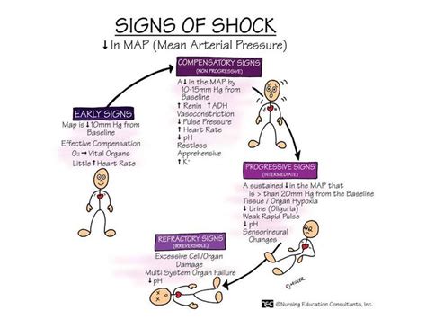 signs  shock nursing mnemonics nursing school survival nursing