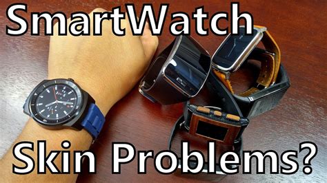 smartwatch heart rate monitors causing skin irritation youtube