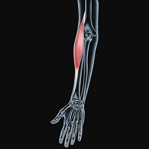 brachioradialis muscle injuries strategies  successful recovery