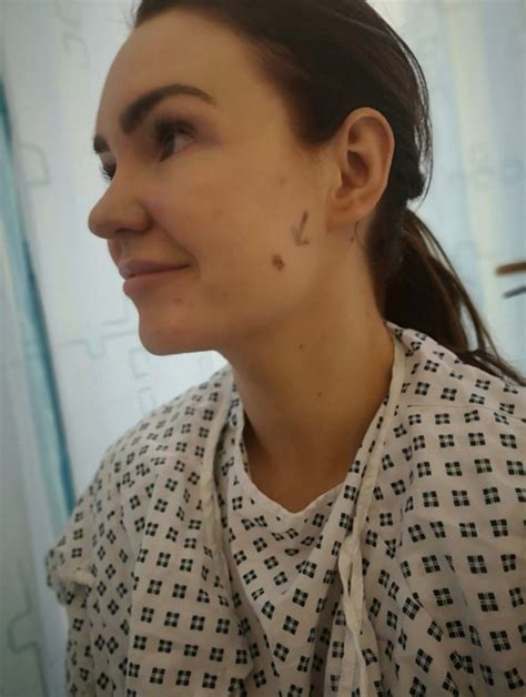 Beauty Therapist Had Cancerous Mole On Her Face Despite Wearing
