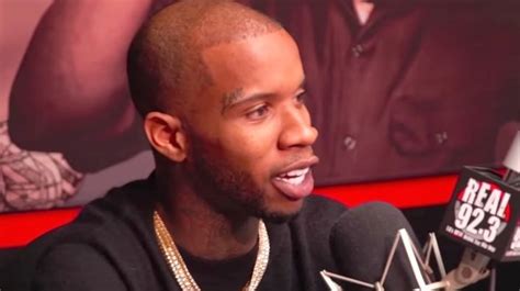 Tory Lanez Admits To Getting His Hairline Fixed