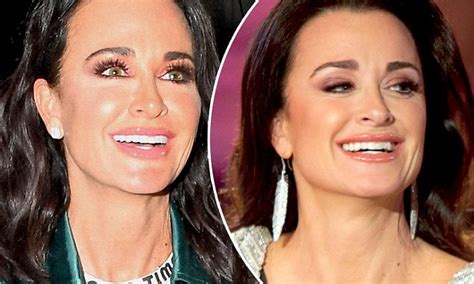 kyle richards flashes veneers after smile makeover daily mail online