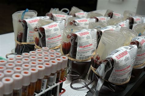 scientists develop ingenious   convert blood  universal donor type