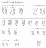 Karyotype Worksheet Answer Key Biology Answers Worksheeto Human Lab Via sketch template