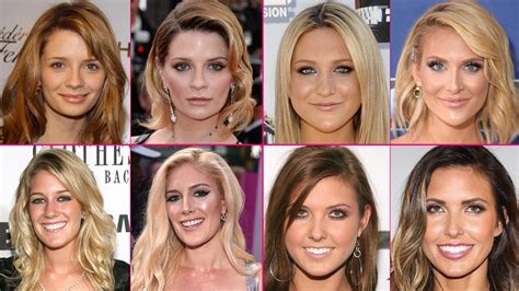 the hills new beginnings cast plastic surgery revealed