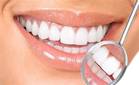 tooth whitening aliso viejo tooth discoloration laguna hills tooth bleaching
