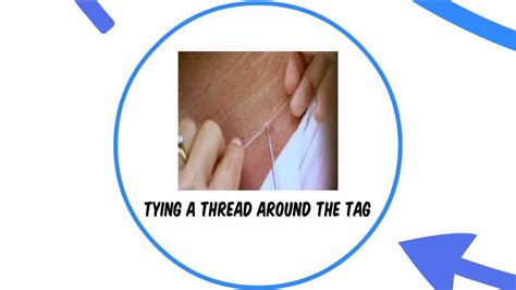 how to remove a skin tag home remedies for skin tags