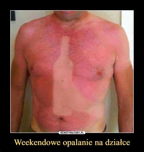 14 best funny sunburns images on pinterest funny sunburn funny tan lines and funny images