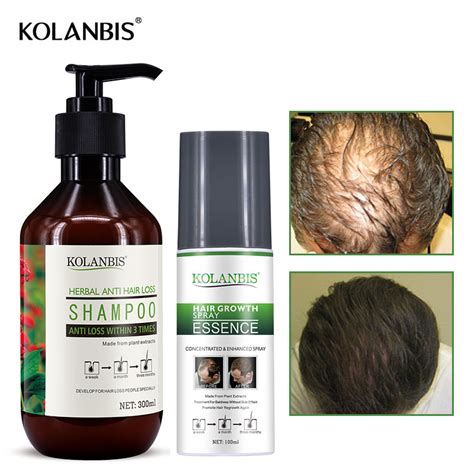 2 Bottles Men Anti Hair Loss Shampoo And Herbal Growth Tonic Essence