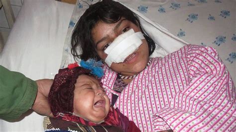 afghan woman s ears cut off by husband bbc news
