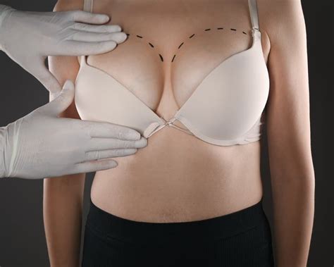 when do you need breast augmentation and a breast lift