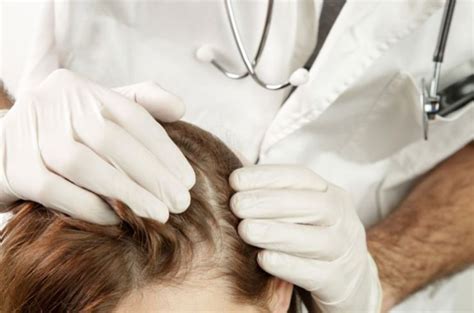 What Are Scalp Infections