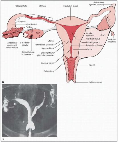 ovary and fallopian tube oncohema key