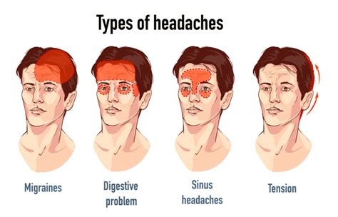 headache causes symptoms diagnosis types and treatment