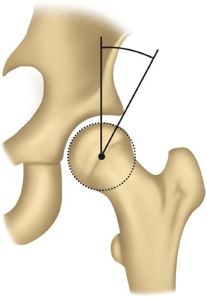 adult hip and knee reconstruction musculoskeletal key