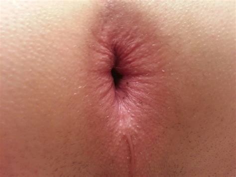 Close Up Assholes 23 Pics Xhamster